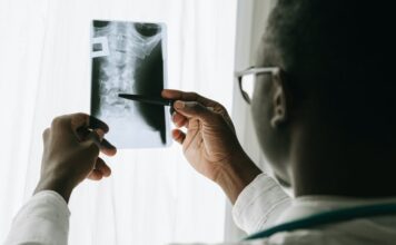 Osteoporóza: Prevence zachraňuje životy